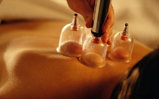 Cupping